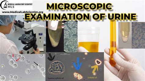 clinical laboratory urine analyzer troubleshooting|clinical laboratory urinalysis guidelines.